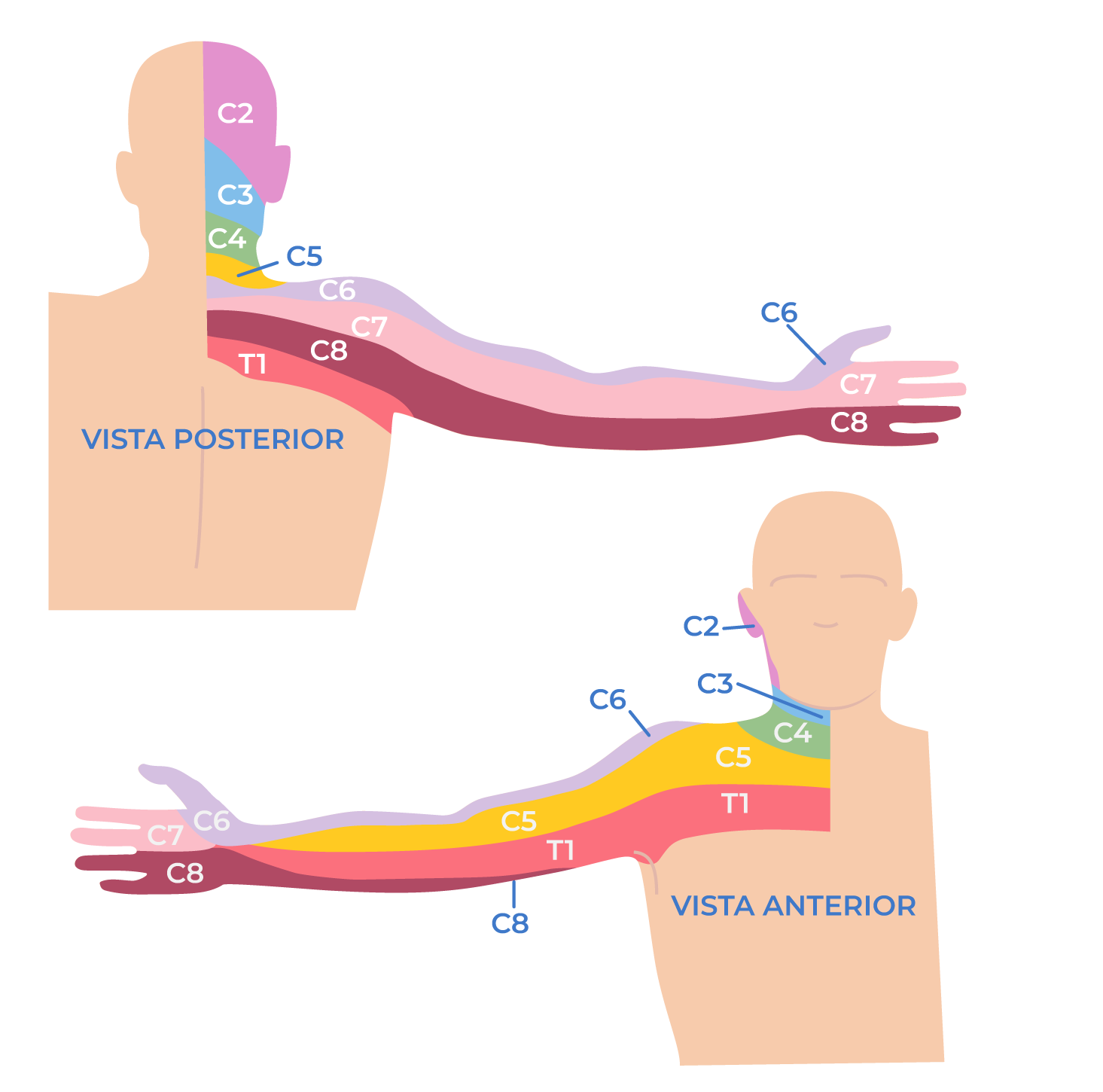 Cervicobraquialgia