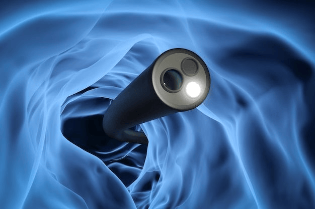 Colonoscopia: qué es, cuándo se indica y cómo prepararse 1 Concepto de tecnología de colonoscopia con endoscopio de rayos x de renderizado 3D dentro del intestino _ Foto Premium