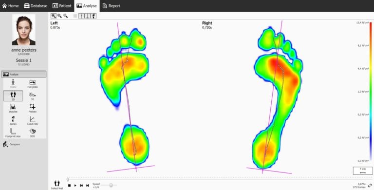 Footscan Clínico / Análisis de Pisada | Clínica MEDS