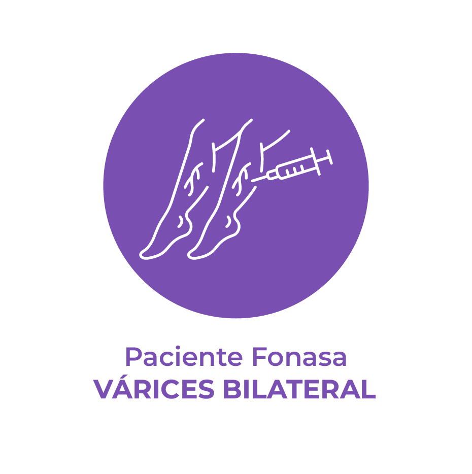 Cirugías a precio fijo Várices Bilaterales