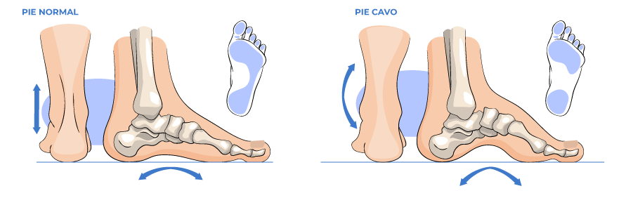 Pie Cavo