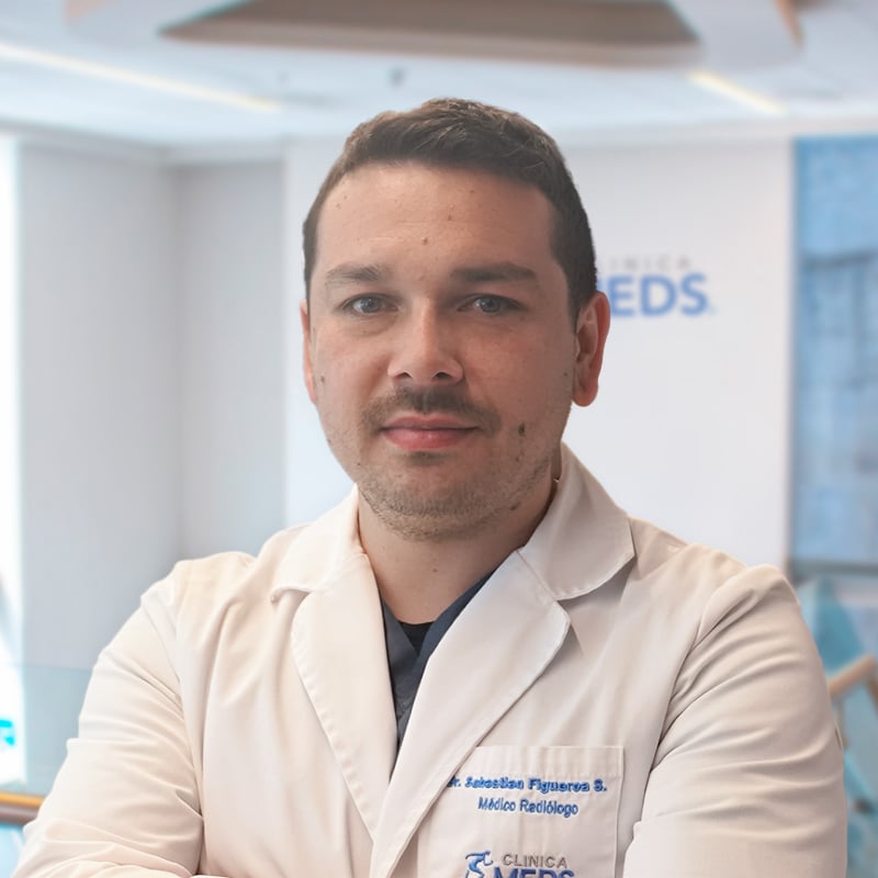 Sebastián Figueroa Saravia | Clínica MEDS