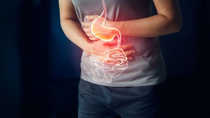Ulcerative Colitis Surgery_ Types, Recovery and Aftercare