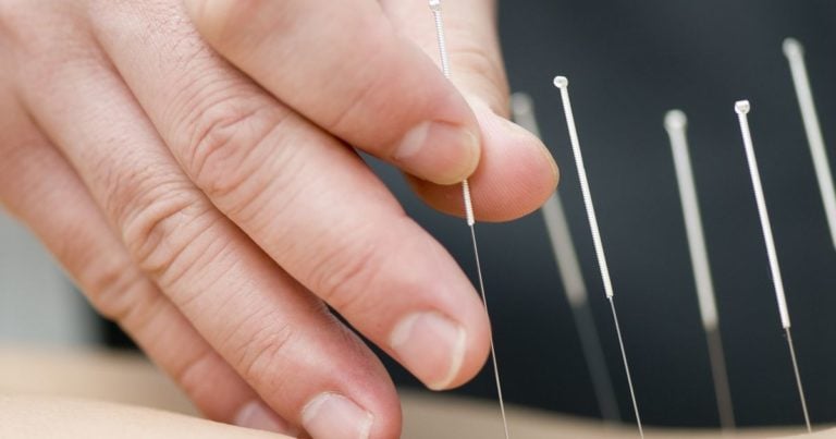 Acupuntura | Clínica MEDS