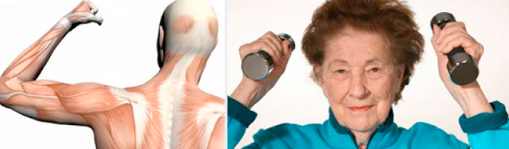 Sarcopenia