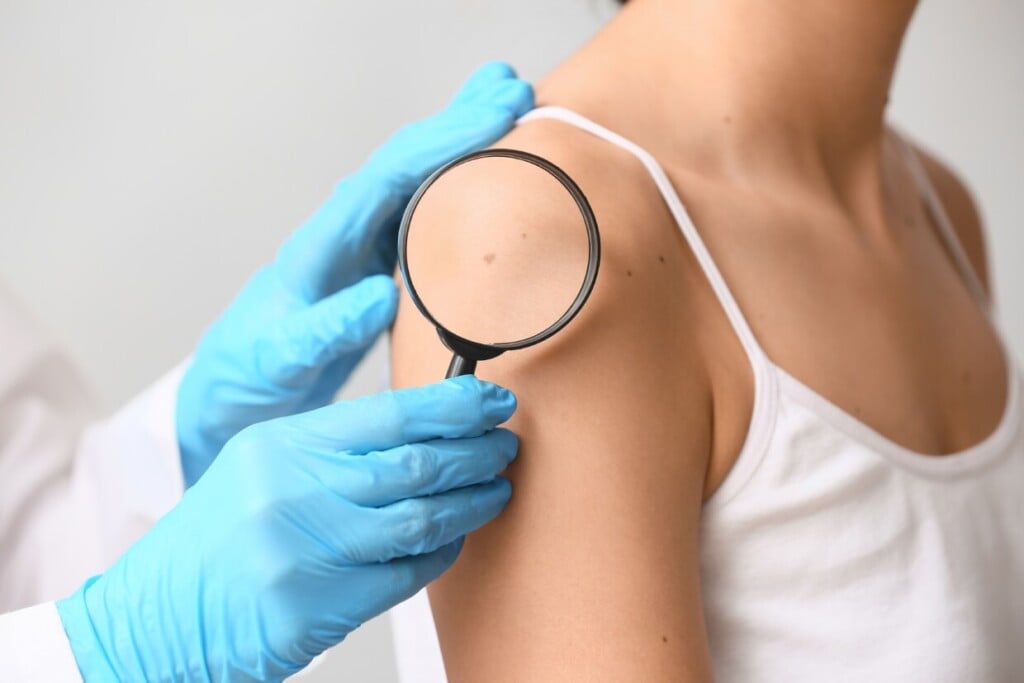 Dermatología | Clínica MEDS