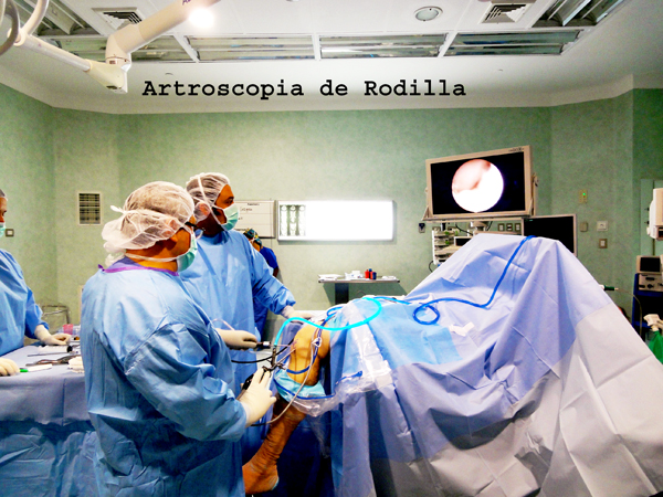 Artroscopía o cirugía artroscópica